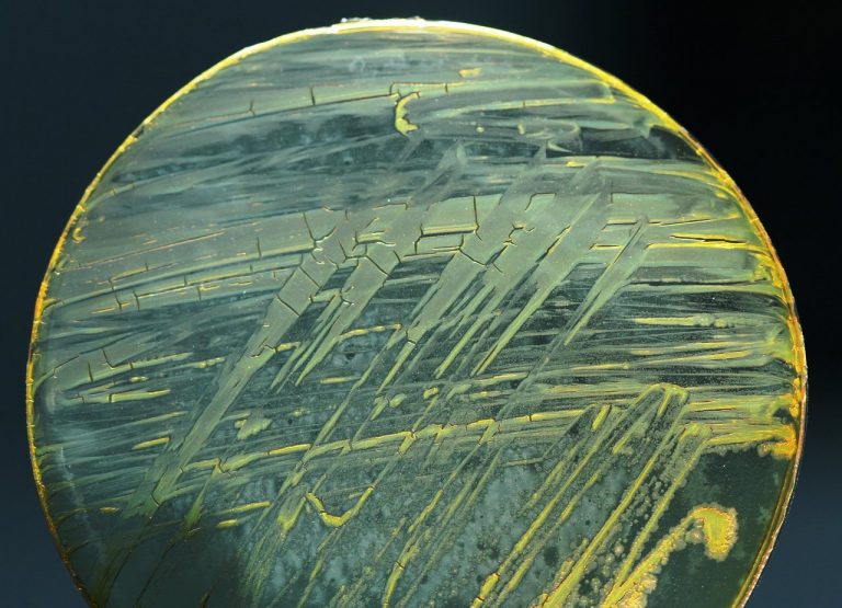 Šílený experiment, nebo převratný lék? Máš depku? Dej si lepru. Vědci vyvíjejí vakcínu proti úzkosti a depresím z bakterie příbuzné tuberkulóze či malomocenství